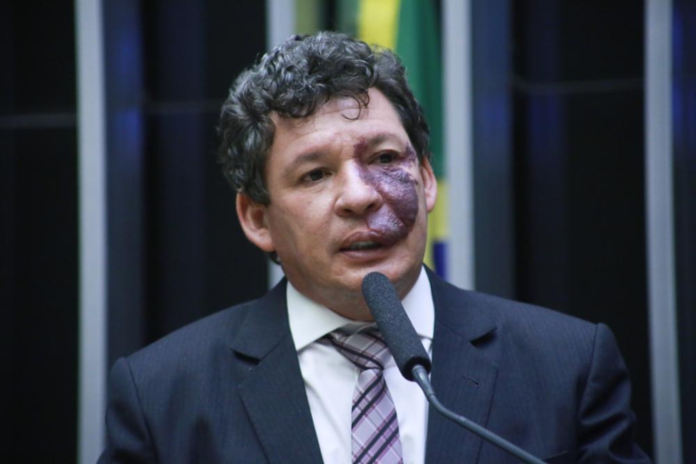Reforma tributária dá chance do país disputar com o mundo, diz deputado